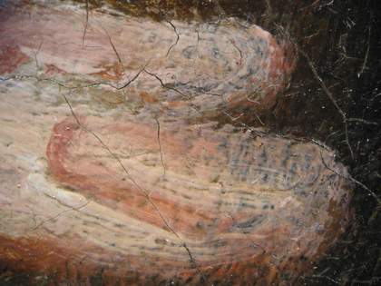 Fig.10 Extension of fingers on sitter’s right hand, photographed at x8 magnification