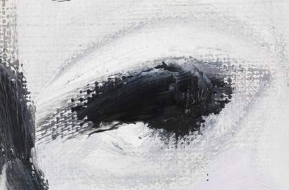 Micrograph of the proper right eye, showing sketchy grey paint