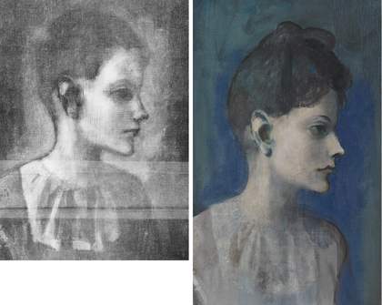 Detail of X-radiograph showing the boy’s head and detail of the same area showing the girl’s head