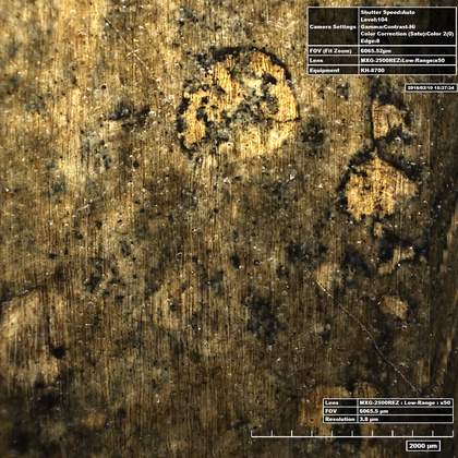 High-resolution micrograph of the left breast