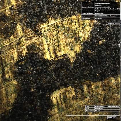 High-resolution micrograph of the underarm area