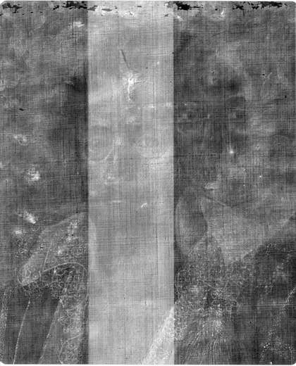 Fig.3 X-radiograph of the sitter’s head, showing the underlying head off-set to the right 