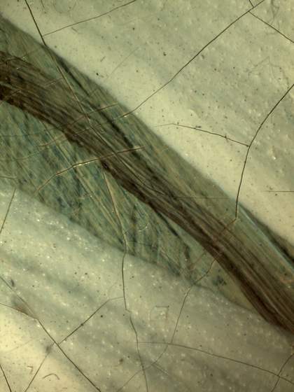 Detail of the base of the collar