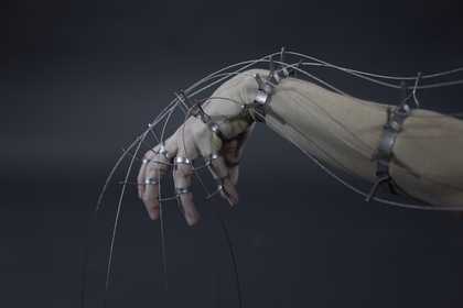 human hand and forearm enclosed in a metal frame