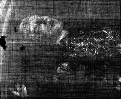 X-ray of Ophelia