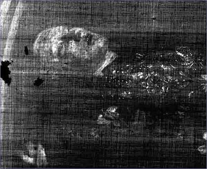 X-ray of Ophelia